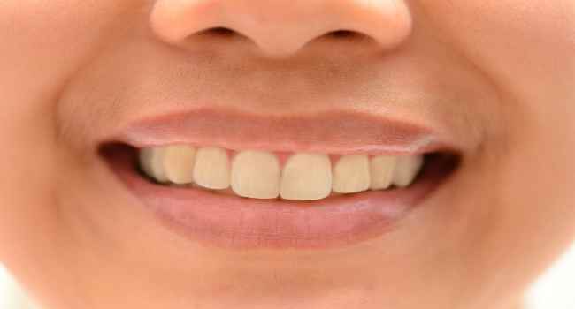 Как восставить зубную эмаль в домашних условиях — здоровье и долголетие